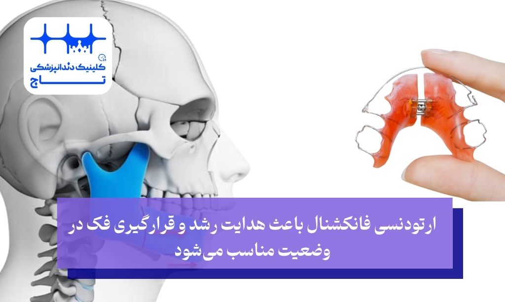 اصلاح ناهنجاری فک