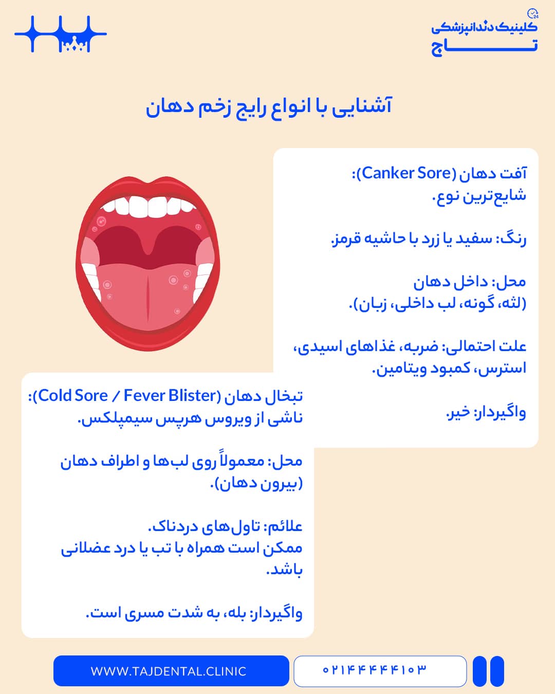 آشنایی با انواع زخم دهان
