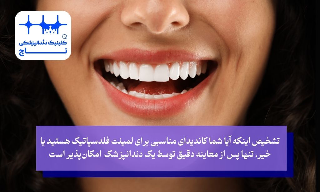 آیا لمینت فلدسپاتیک برای دندان‌های من مناسب است؟ یک چک‌لیست خودارزیابی