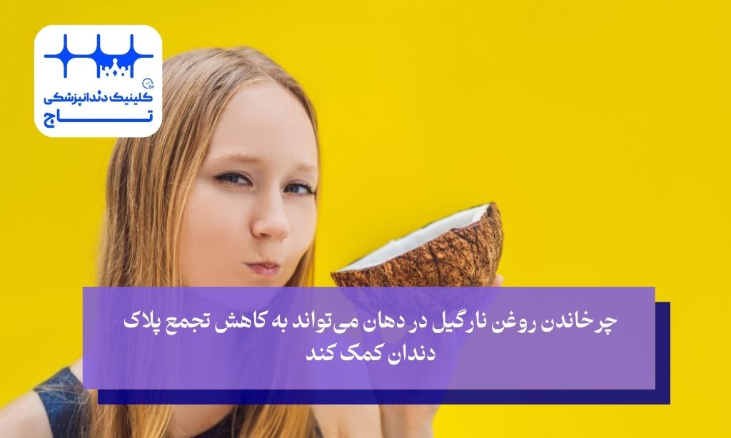 روغن نارگیل و از بین رفتن پلاک دندان