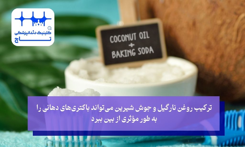 روغن نارگیل و جوش شیرین برای دندان