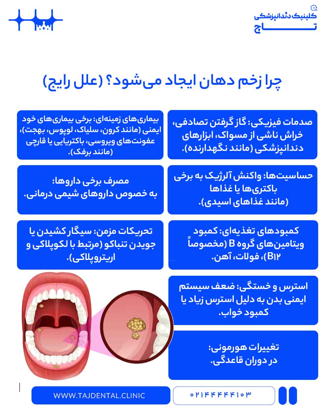 علت زخم دهان و گلو چیست؟