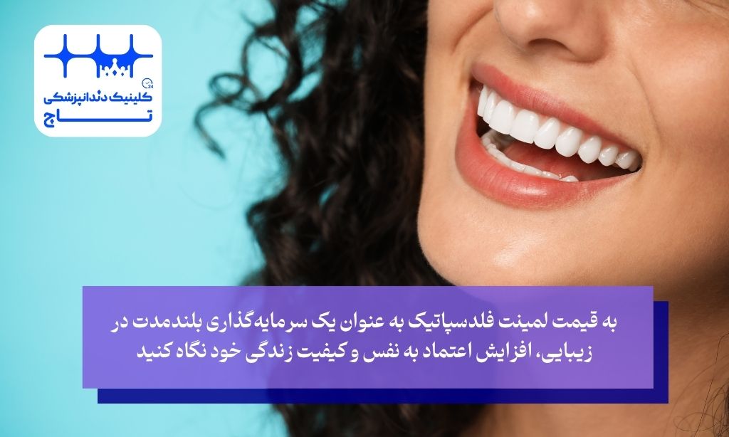 قیمت لمینت فلدسپاتیک؛ سرمایه‌گذاری روی زیبایی و اعتماد به نفس شما