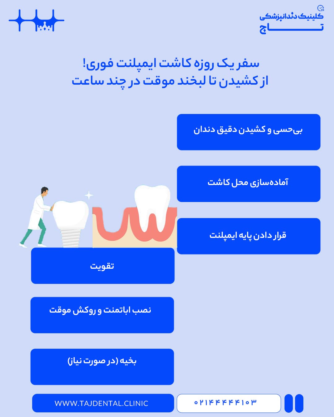 مراحل کاشت ایمپلنت فوری دندان