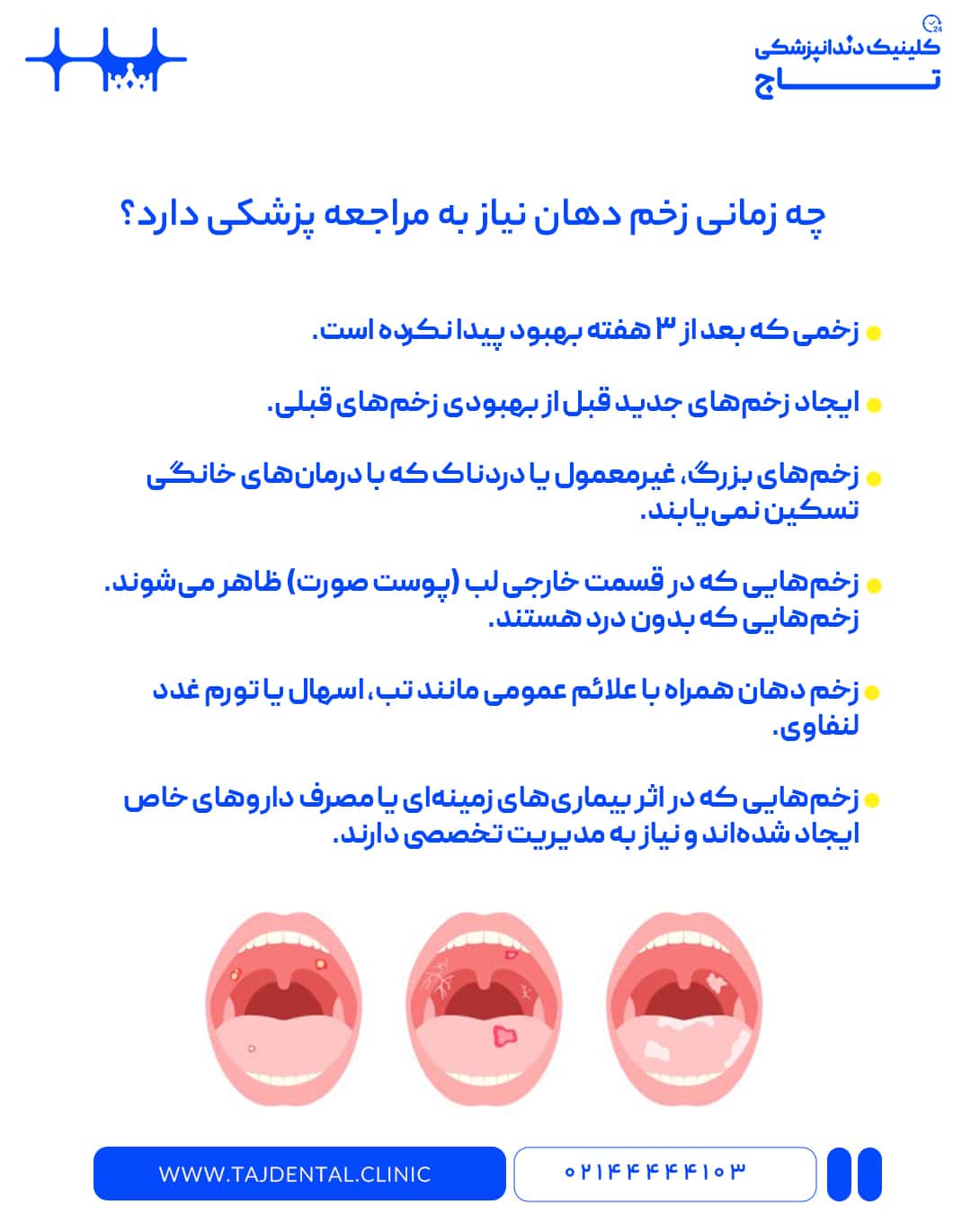 مشاوره درمانی تخصصی زخم دهان در کلینیک شبانه روزی دندانپزشکی تاج