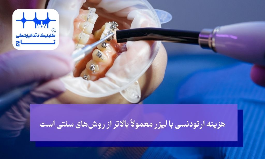 هزینه ارتودنسی با لیزر معمولاً بالاتر از روش‌های سنتی است