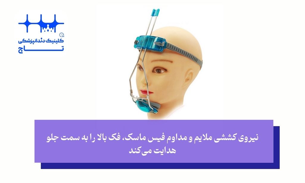 چرا فرزند من به فیس ماسک ارتودنسی نیاز دارد