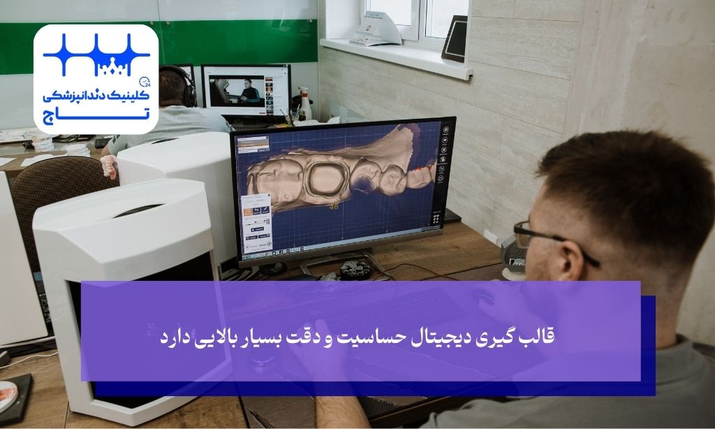 قالب ‌گیری دیجیتال حساسیت و دقت بسیار بالایی دارد