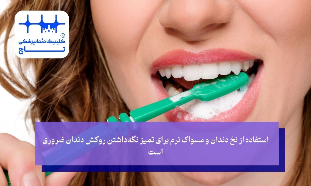 استفاده از نخ دندان و مسواک نرم برای تمیز نگه‌داشتن روکش دندان ضروری است