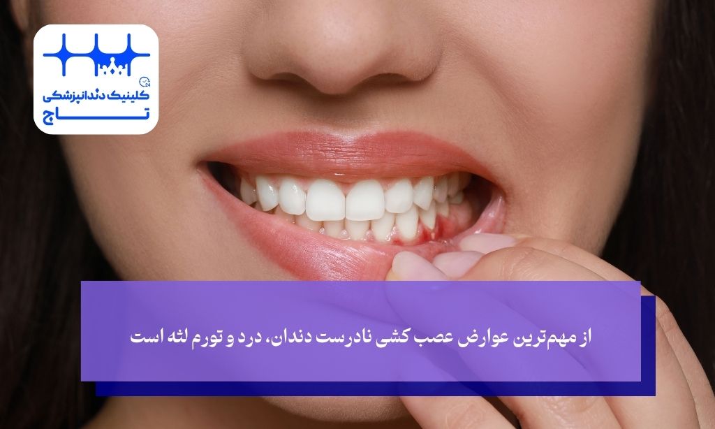 از مهم‌ترین عوارض عصب کشی نادرست دندان، درد و تورم لثه است