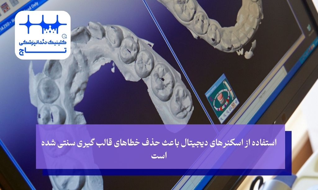 استفاده از اسکنرهای دیجیتال باعث حذف خطاهای قالب ‌گیری سنتی شده است