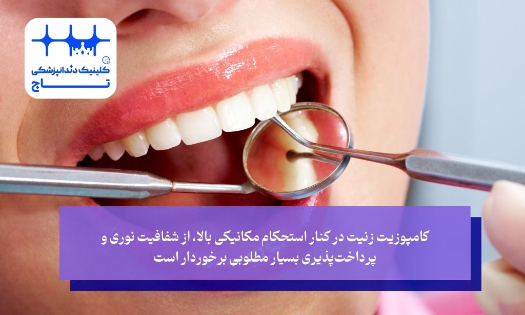 کامپوزیت زنیت در کنار استحکام مکانیکی بالا، از شفافیت نوری و پرداخت‌پذیری بسیار مطلوبی برخوردار است