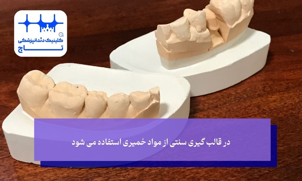 در قالب ‌گیری سنتی از مواد خمیری استفاده می شود