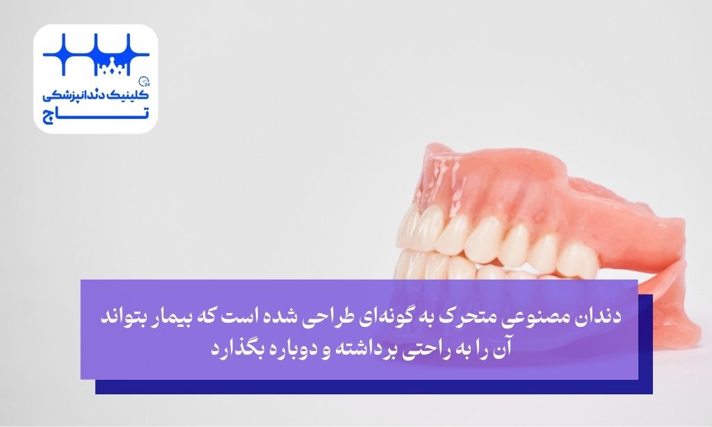 دندان مصنوعی متحرک