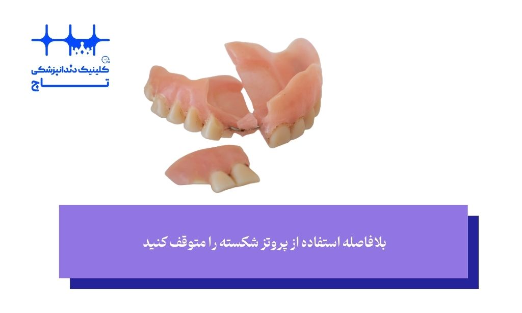 دندان مصنوعی من شکسته است؛ راه حل صحیح و فوری چیست