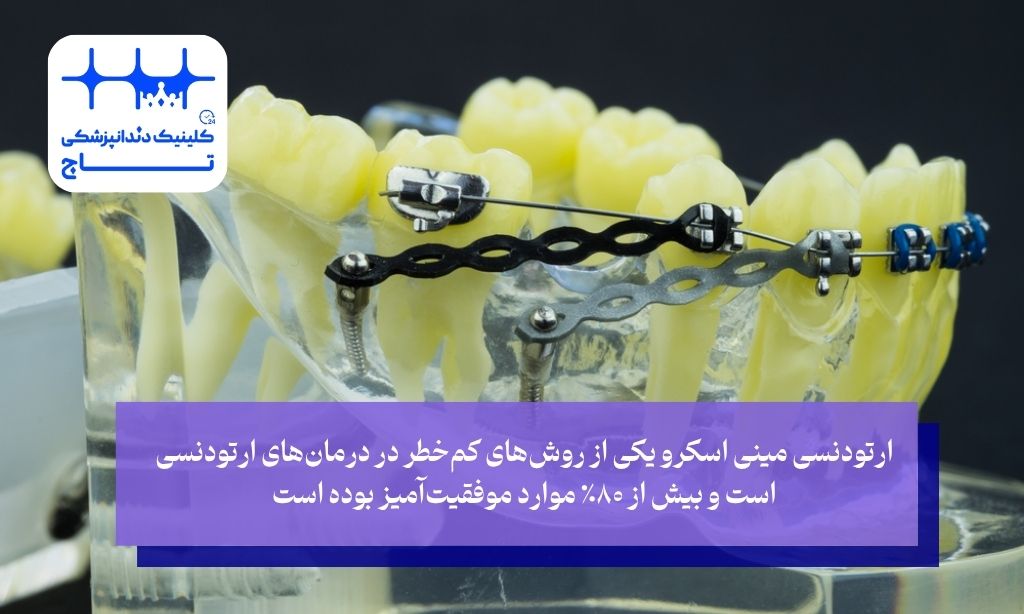 عوارض ارتودنسی مینی اسکرو