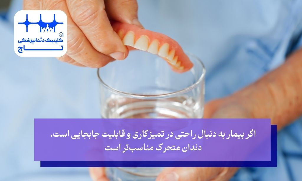 مزایای دندان مصنوعی متحرک