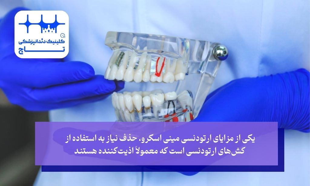 مزایای مینی اسکرو