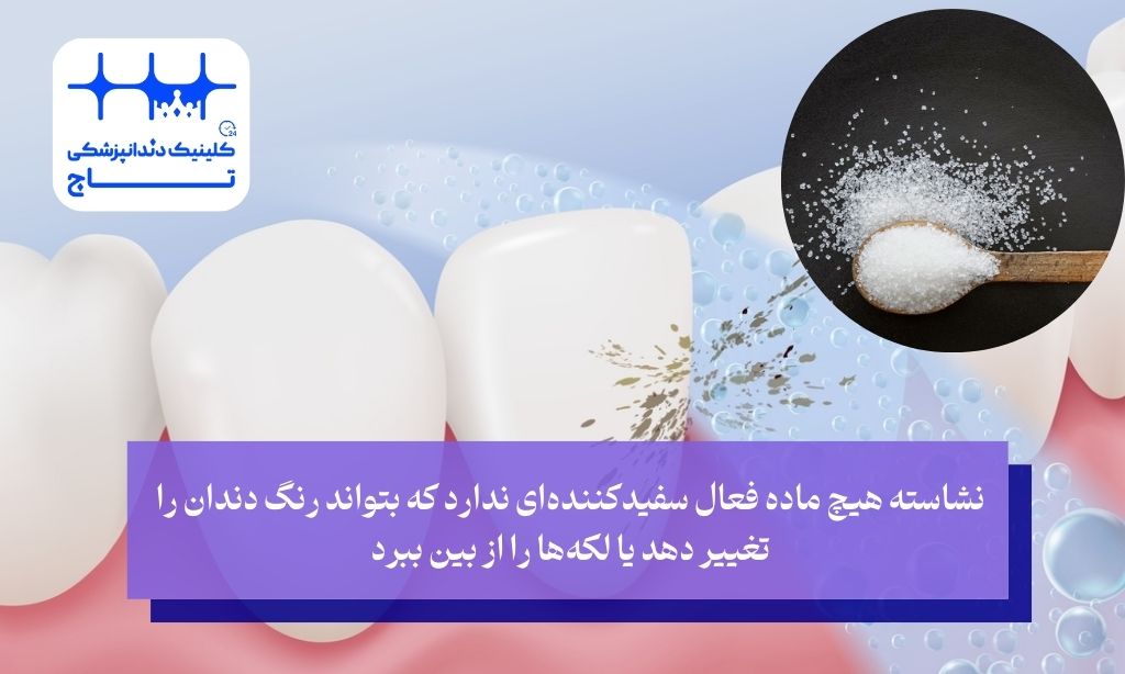 نشاسته و دندان