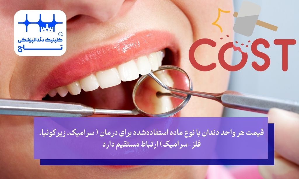 قیمت هر واحد دندان به عوامل زیر وابسته است:

نوع ماده استفاده‌شده: سرامیک، زیرکونیا، فلز-سرامیک
