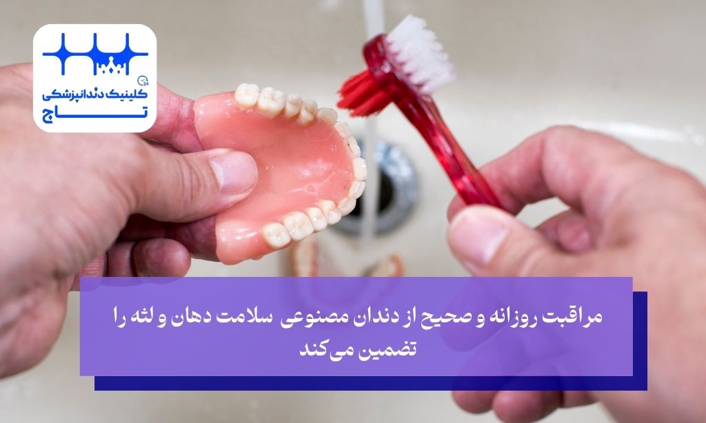 شستشو و مشکلات دندان مصنوعی