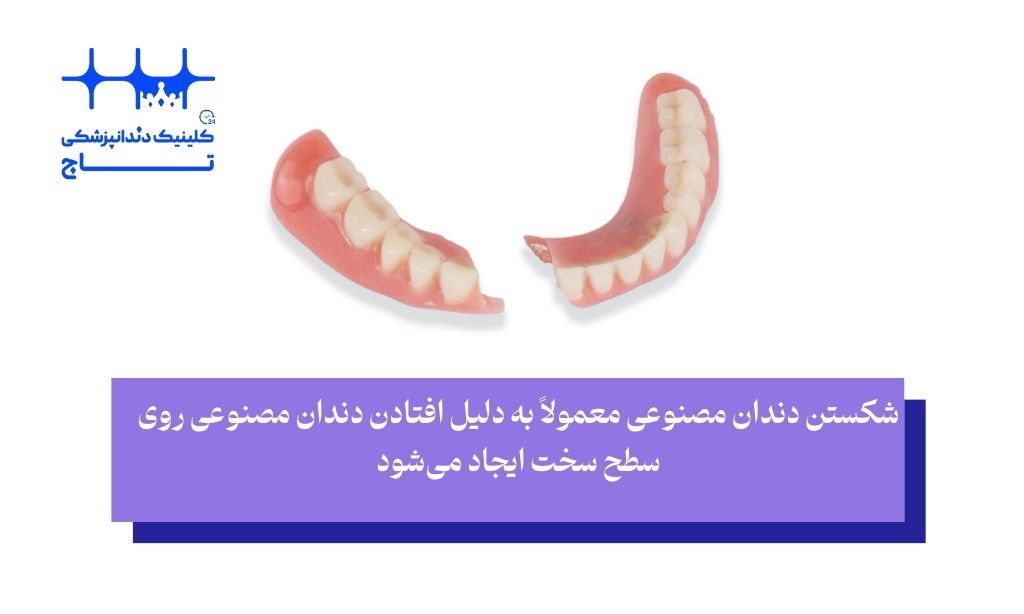 شکستن یکی از مشکلات دندان مصنوعی است