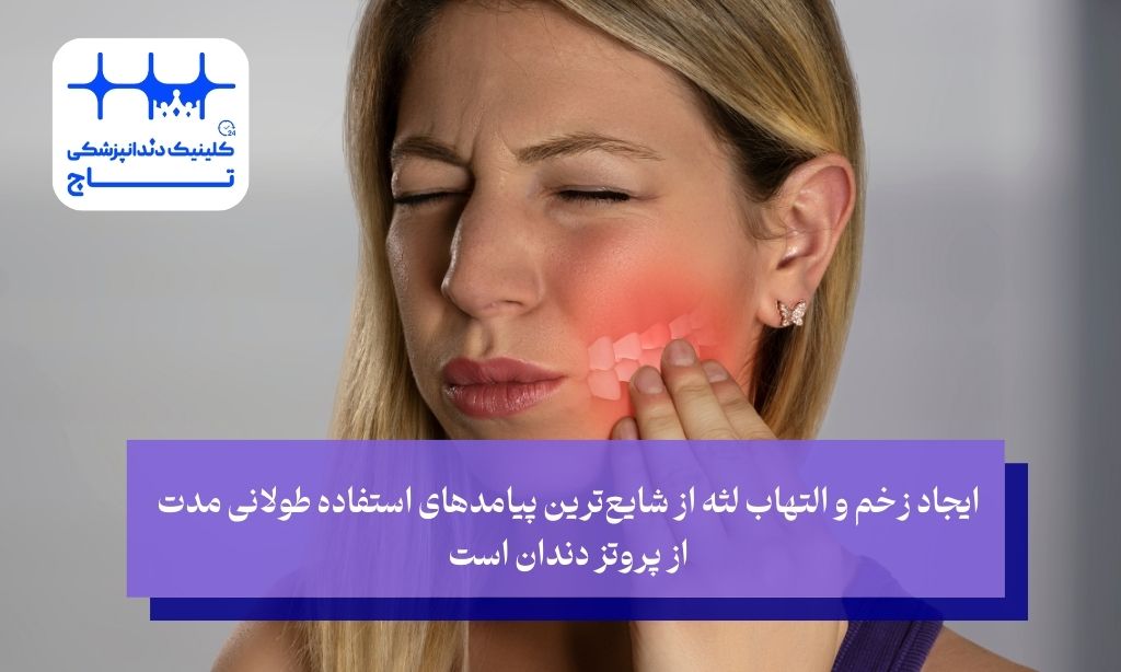 التهاب لثه و مشکلات دندان مصنوعی