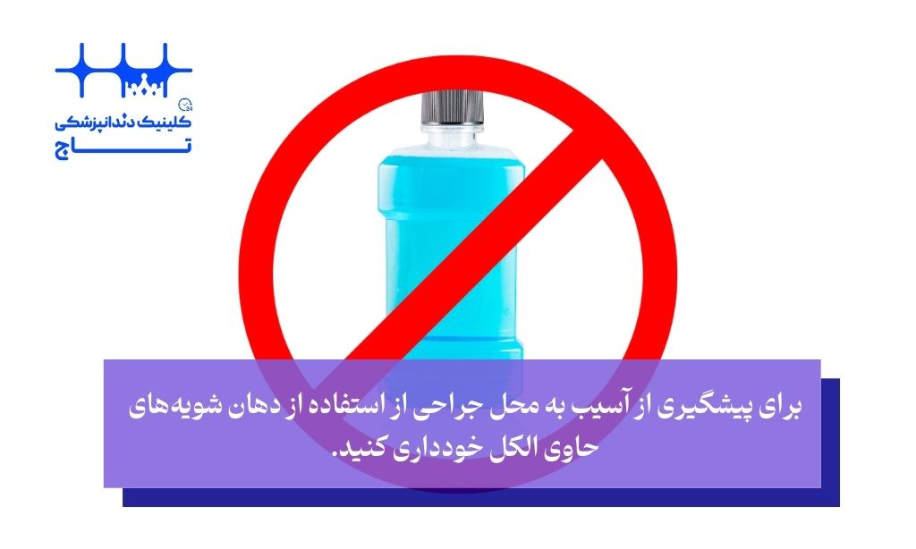 آب نمک بعد از ایمپلنت و اثرات دهانشویه