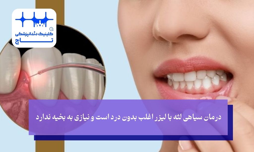 برتری درمان سیاهی لثه با لیزر