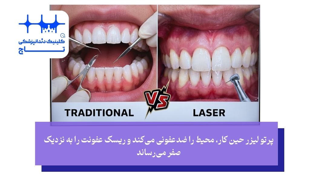 لیفت لثه با لیزر بهتر است یا جراحی سنتی؟