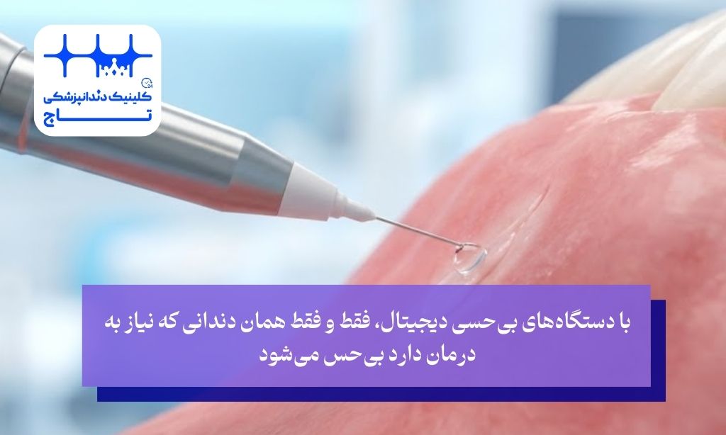 مزیت طلایی دیجیتال دنتیستری؛ بی‌حسی تک دندان (STA) چیست؟