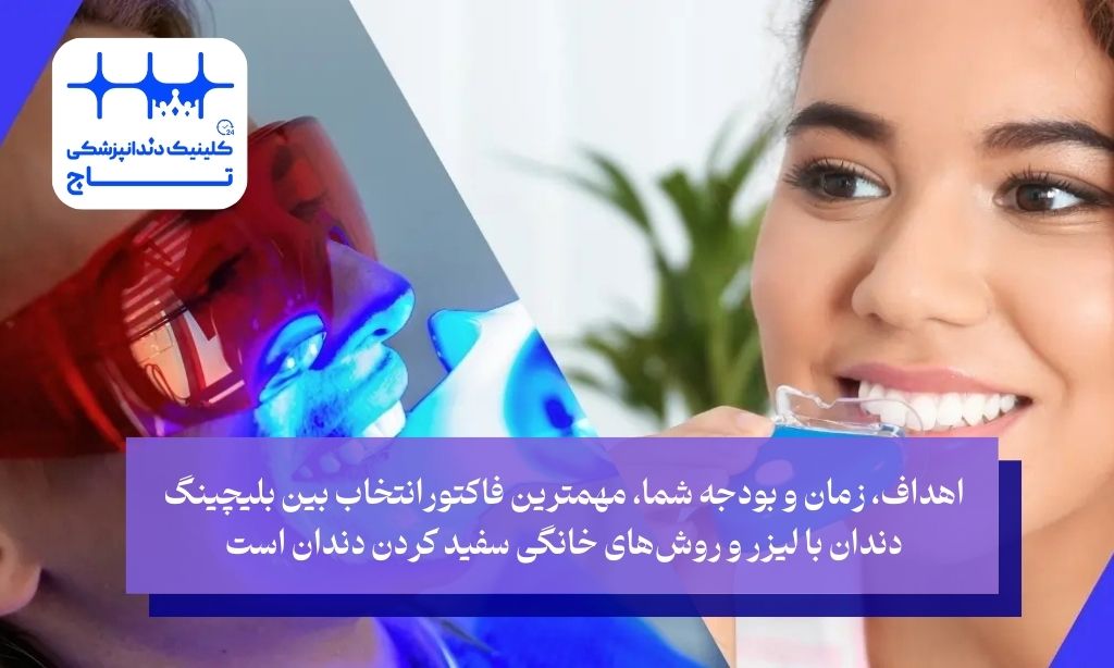مقایسه بلیچینگ با لیزر و روش خانگی