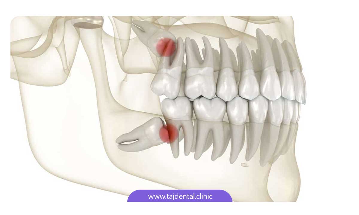 آناتومی دهان و دندان