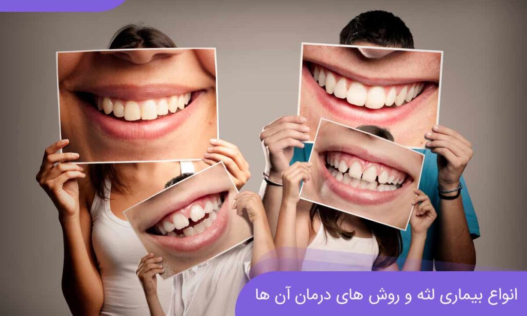 بهداشت دهان و دندان