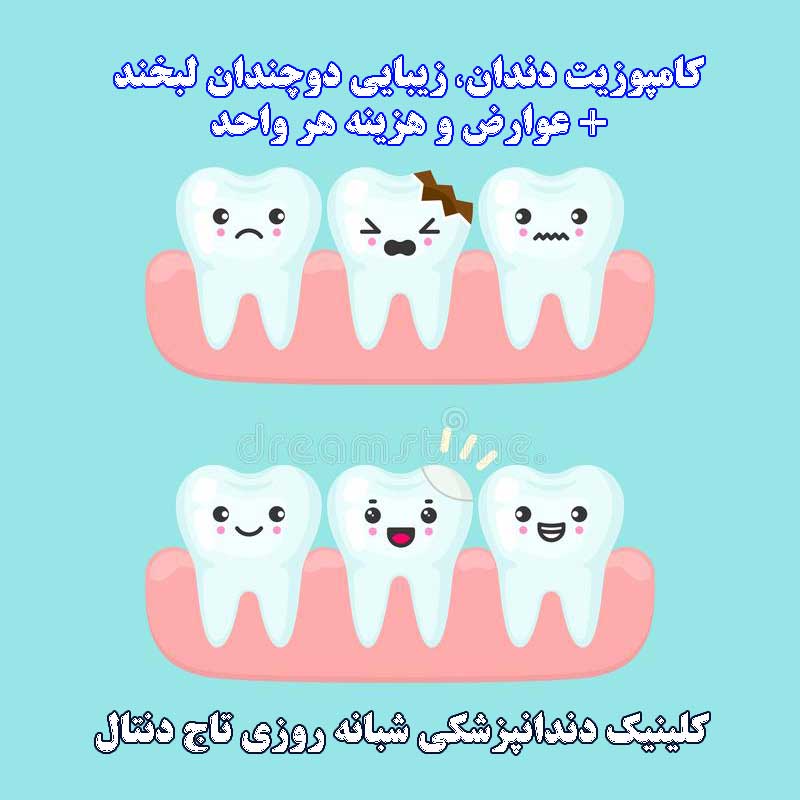 کامپوزیت دندان