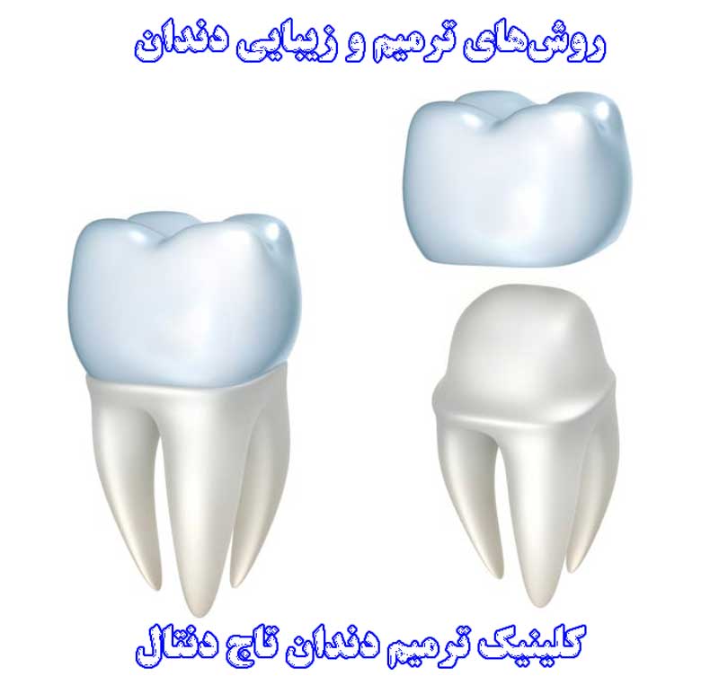 ترمیم دندان