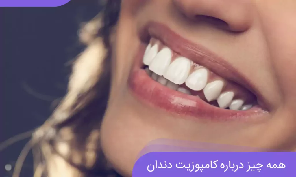 عکس اصلاح طرح لبخند با کامپوزیت دندان