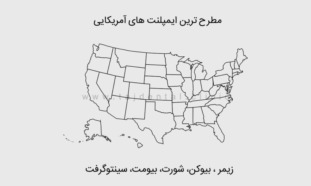 نام و قیمت انواع ایمپلنت آمریکایی