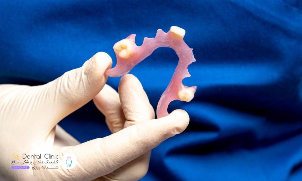 عکس دندان مصنوعی ژله ای در دست یک دکتر