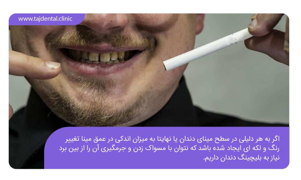اینفوگرافی که در آن درباره شرایط انجام بلیچینگ توضیحات کوتاهی ارائه شده است