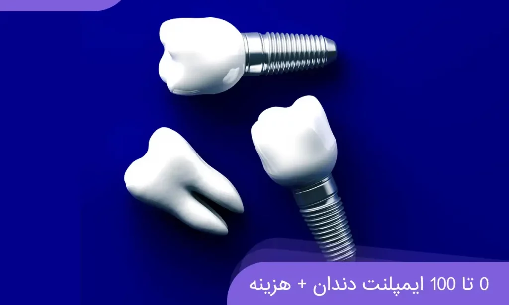عکس ایمپلنت دندان 3 عدد در کنار هم