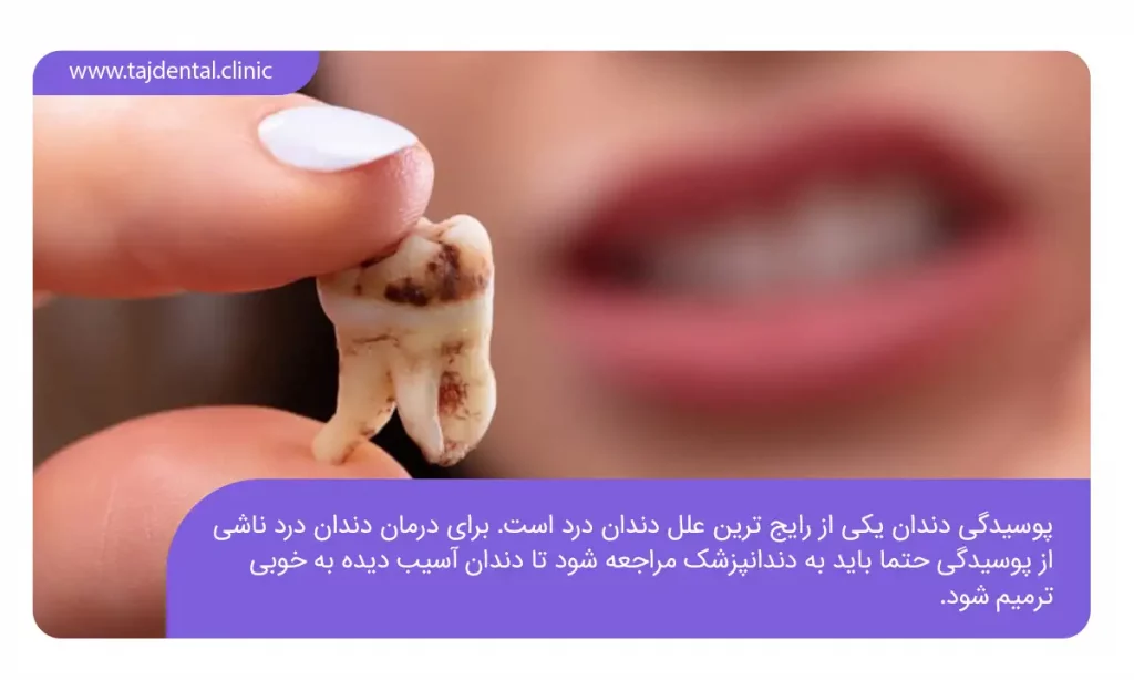 اینفوگرافی دندان درد ناشی از پوسیدگی