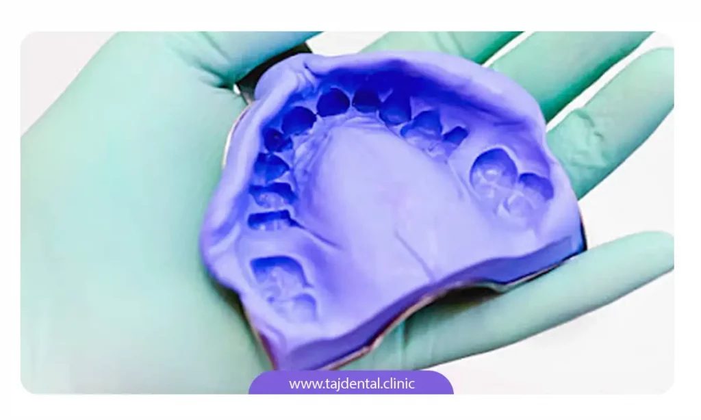 عکس ایمپرشن یا قالب برای ارتودنسی دندان