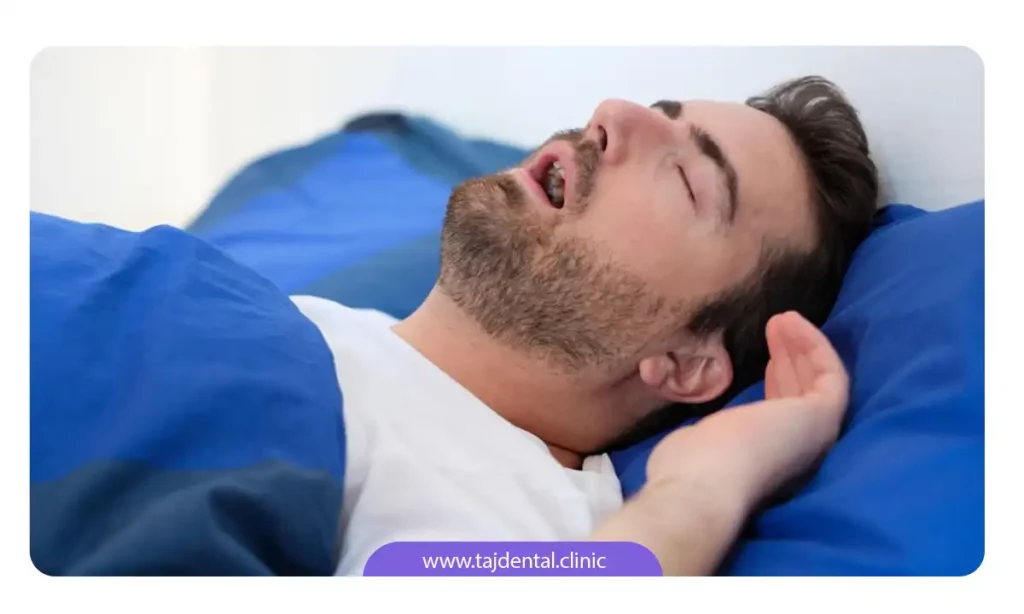مردی که با دهان باز در حال خوابیدن است