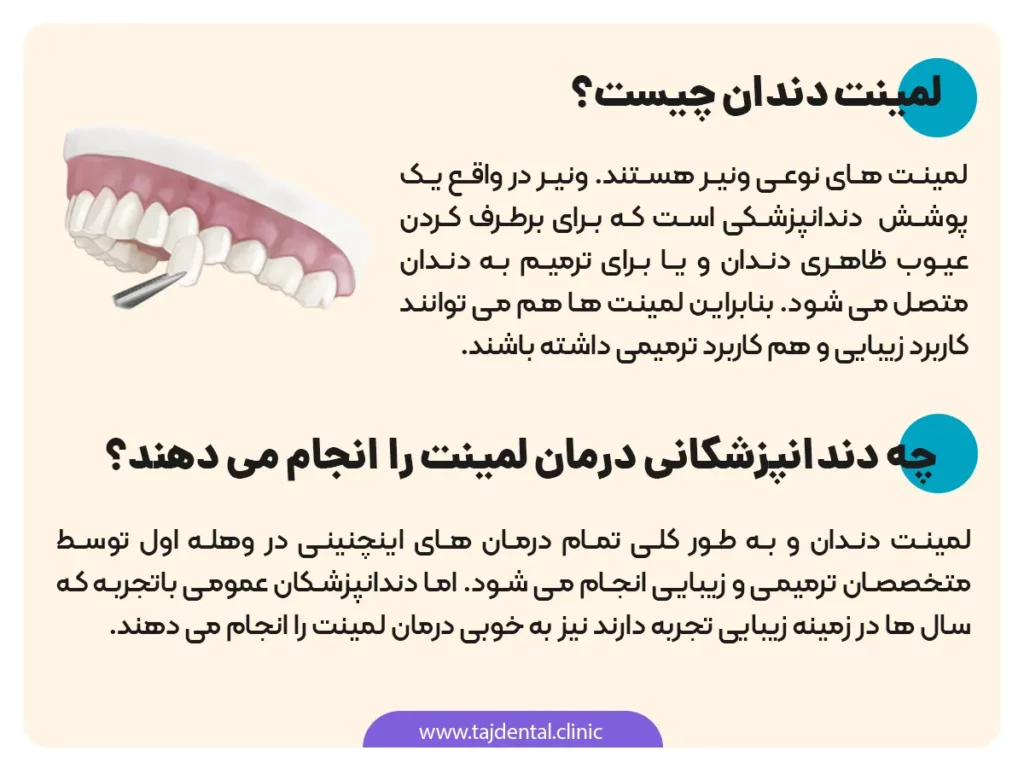 اینفوگرافی لمینت دندان