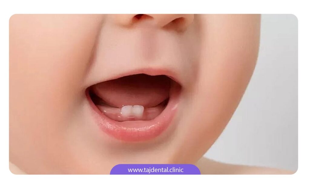اهمیت مسواک زدن دندان شیری