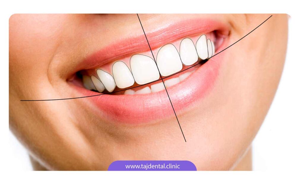 پروسه های دندانپزشکی برای دستیابی به طرح لبخند