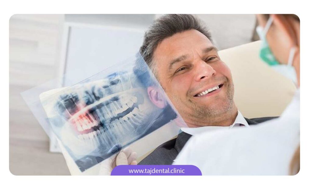 مشاوره و ارزیابی بیمار برای انجام مراحل ایمپلنت دندان