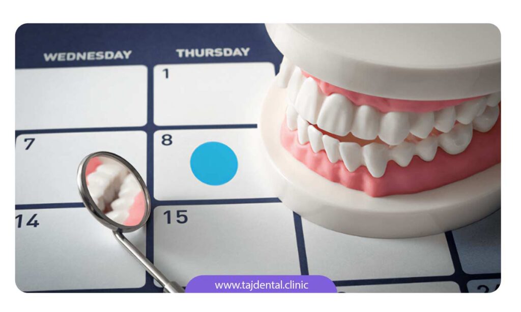 ایمپلنت دندان چقدر زمان می برد؟