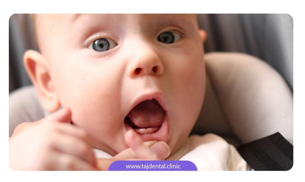 عکس لثه نوزاد هنگام دندان درآوردن